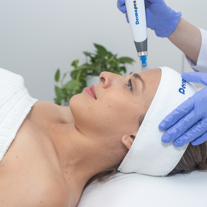 Dermapen Treatment